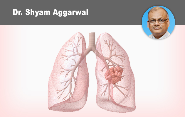 What's New In Lung Cancer?